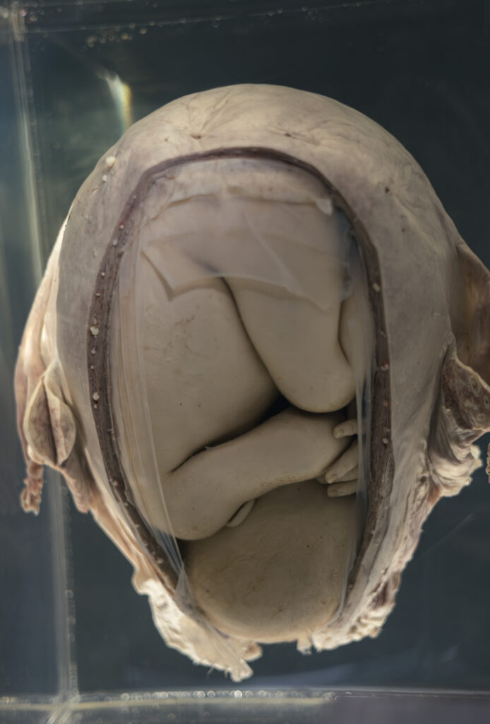 hunterian_museum_john_hunter_collection