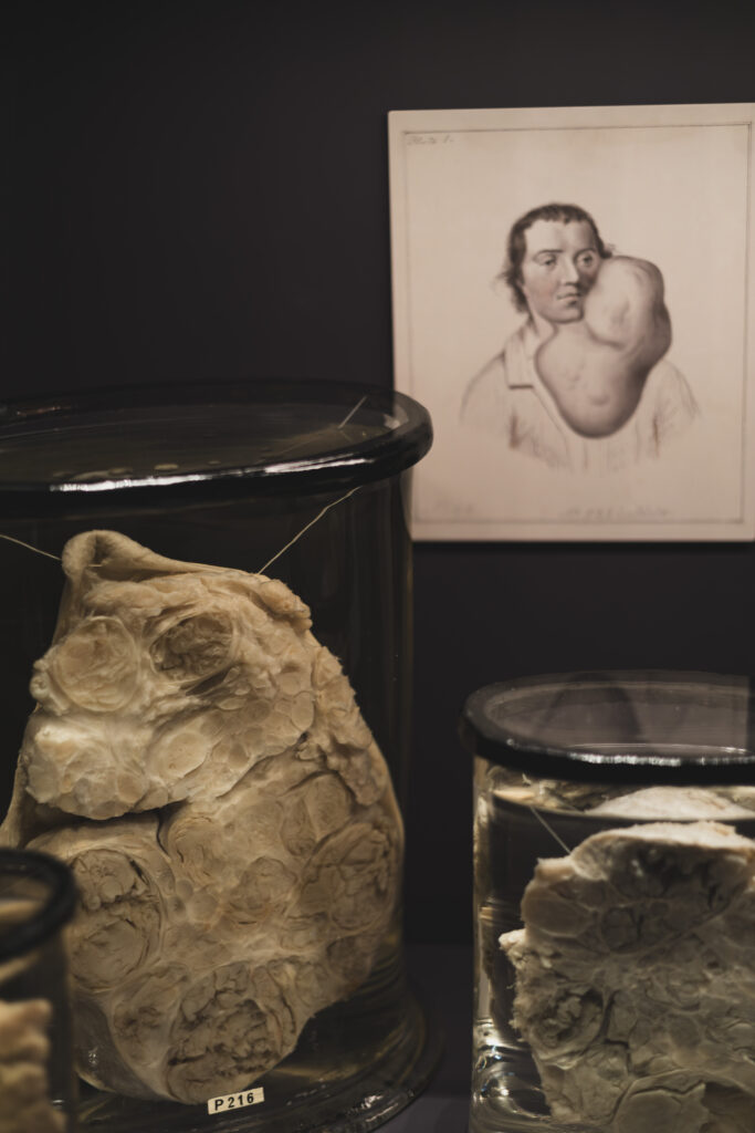 hunterian_museum_john_hunter_collection