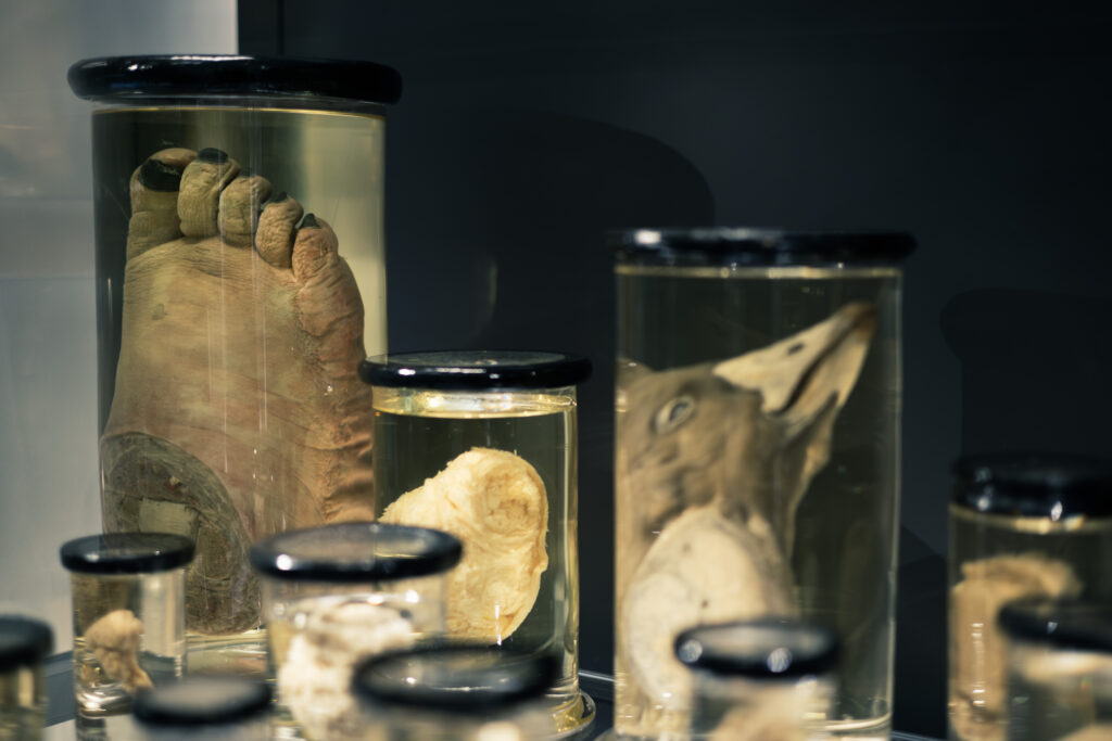 john_hunter_collection_hunterian_museum_london