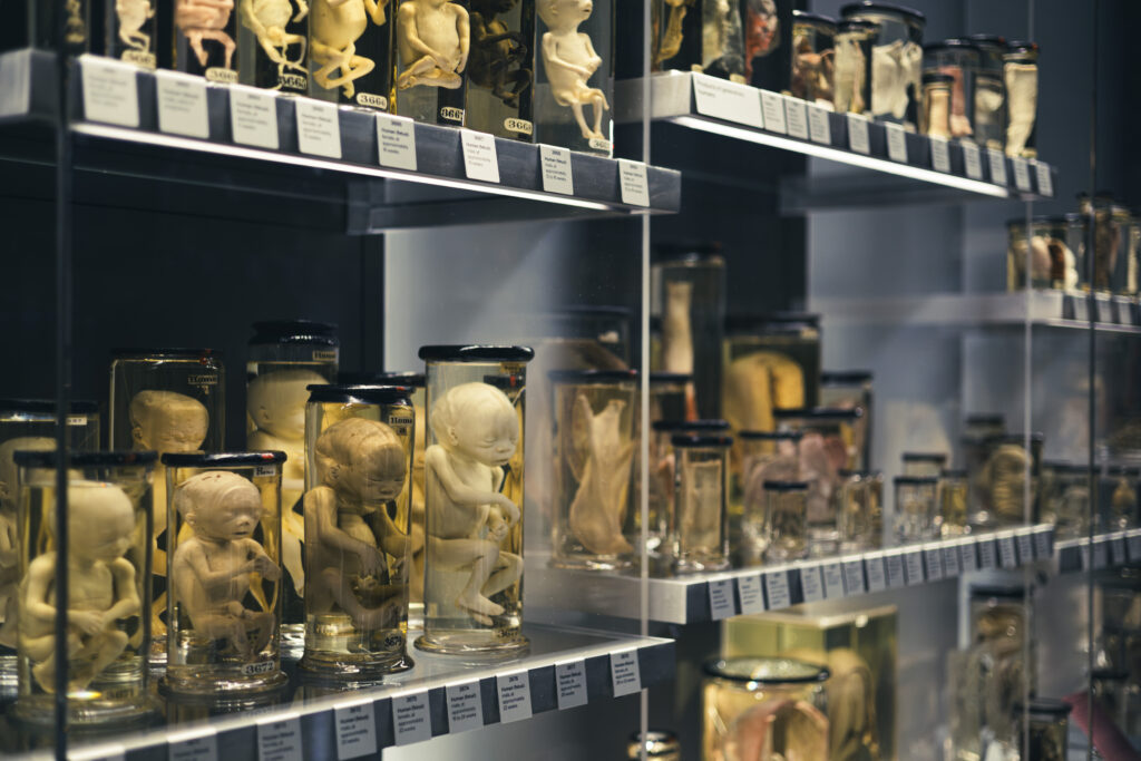 hunterian_museum_john_hunter_collection