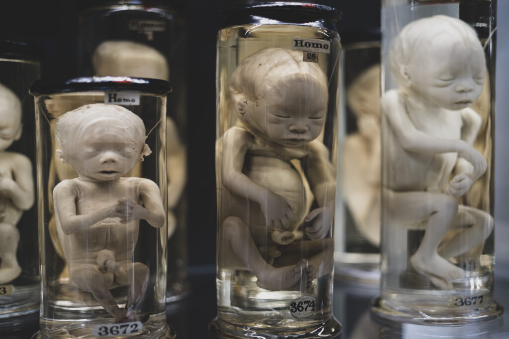 hunterian_museum_john_hunter_collection