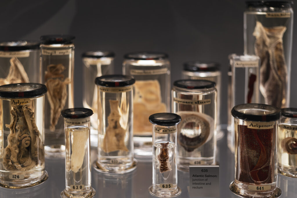 hunterian_museum_john_hunter_collection