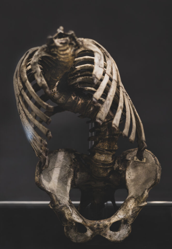 hunterian_museum_john_hunter_collection