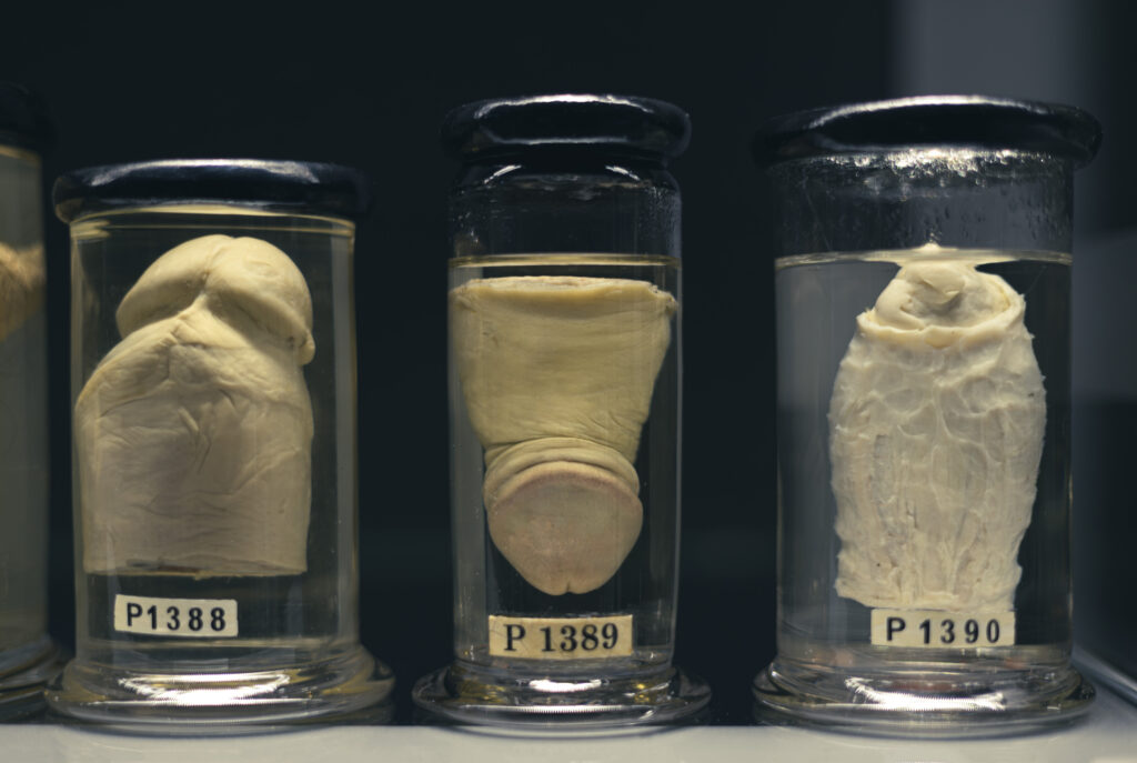 hunterian_museum_john_hunter_collection