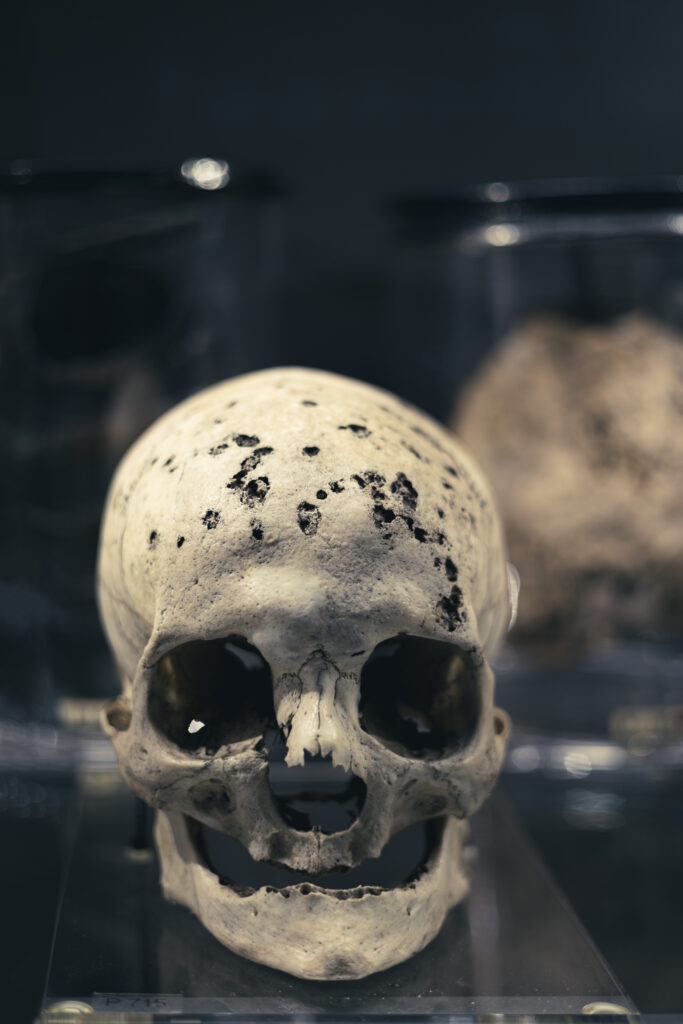 hunterian_museum_john_hunter_collection