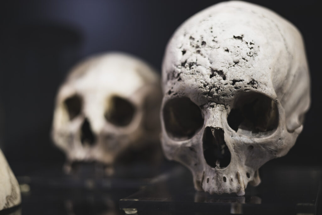 hunterian_museum_john_hunter_collection