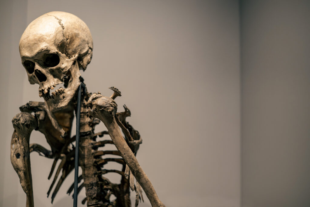 hunterian_museum_john_hunter_collection