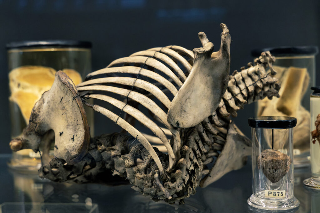 hunterian_museum_john_hunter_collection